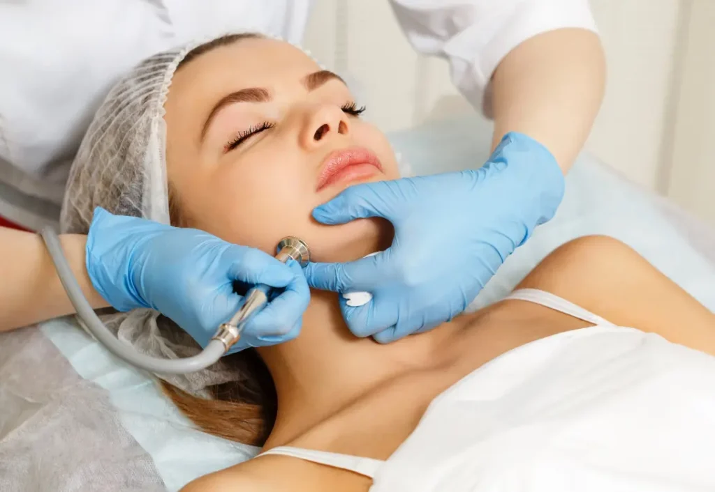 Microdermabrasion