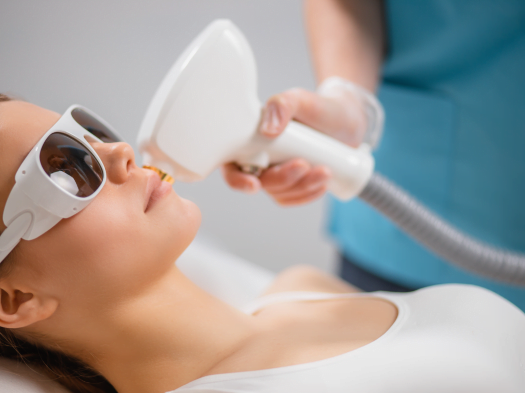 IPL Photofacials - MD SPA