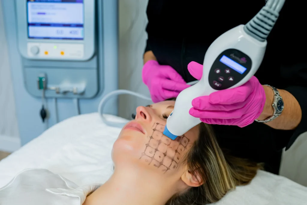 Thermage Skin Tightening Treatments Beaumont